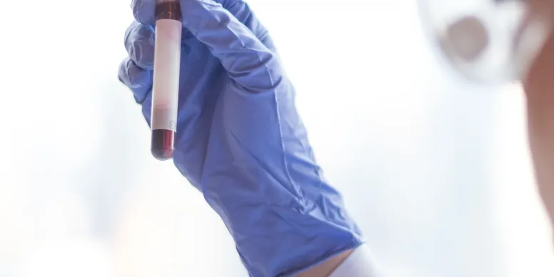 rs=w_776,h_388,cg_true (5)